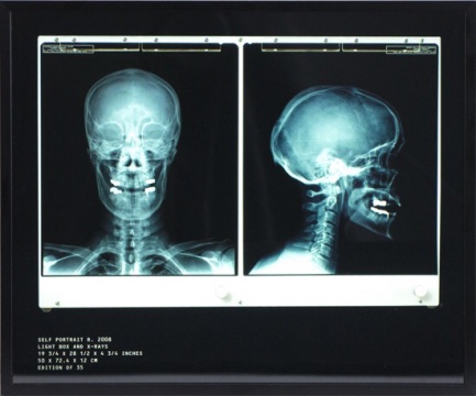 自画像 达明·赫斯特，2008 